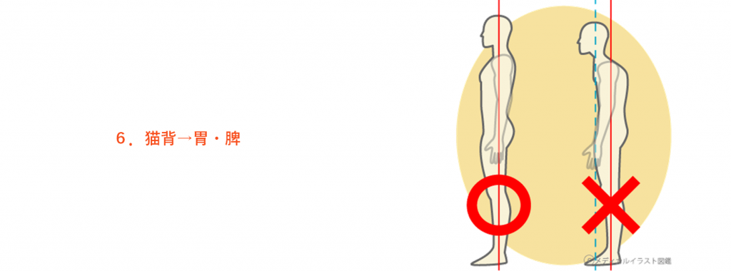腰痛の原因になりうる猫背について解説